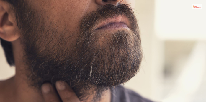 What Causes Dandruff In Beard