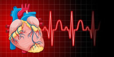 Abnormal Heart Rhythms