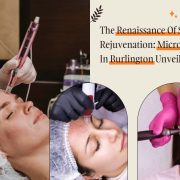 Microneedling In Burlington