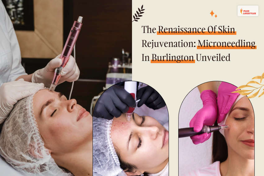 Microneedling In Burlington