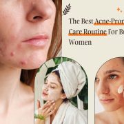 acne skin care routine
